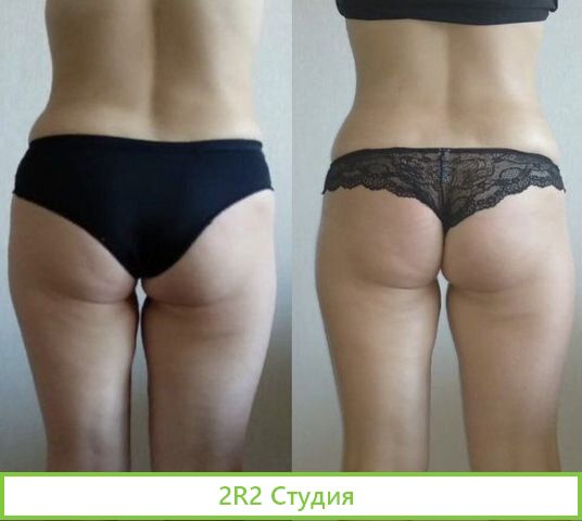 Продам готовый бизнес спа студия